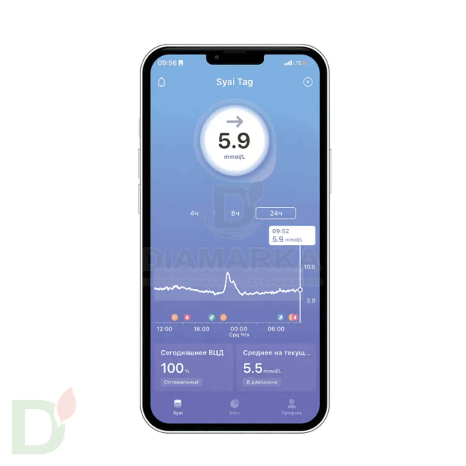 Сенсор (датчик) Syai X1